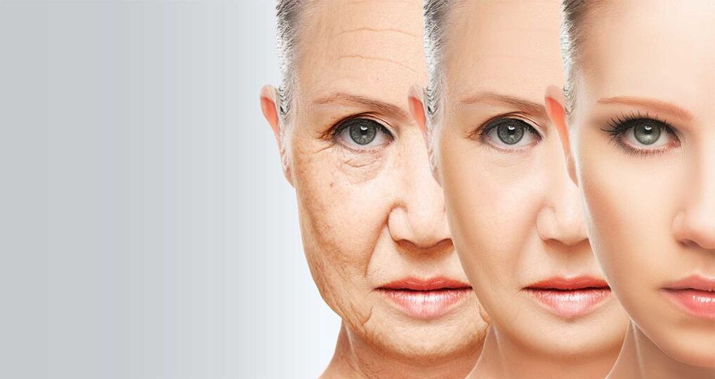 Trẻ hóa da mặt bằng công nghệ laser