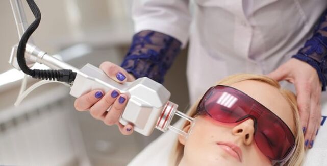 Nguyên tắc trẻ hóa khuôn mặt bằng laser