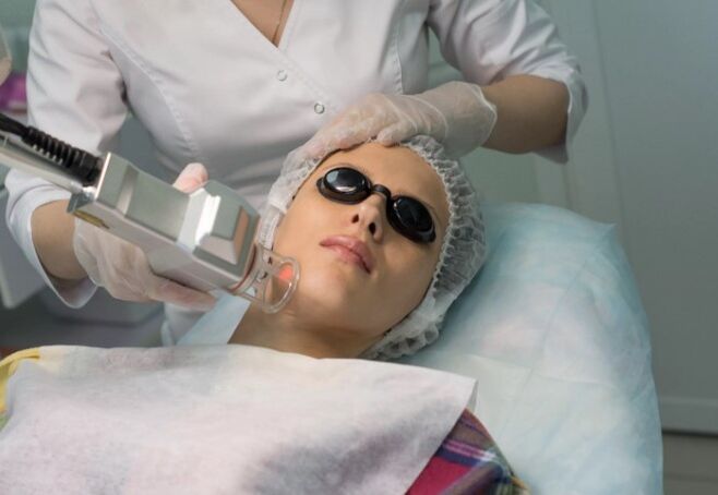 Trẻ hóa hiện trường bằng laser